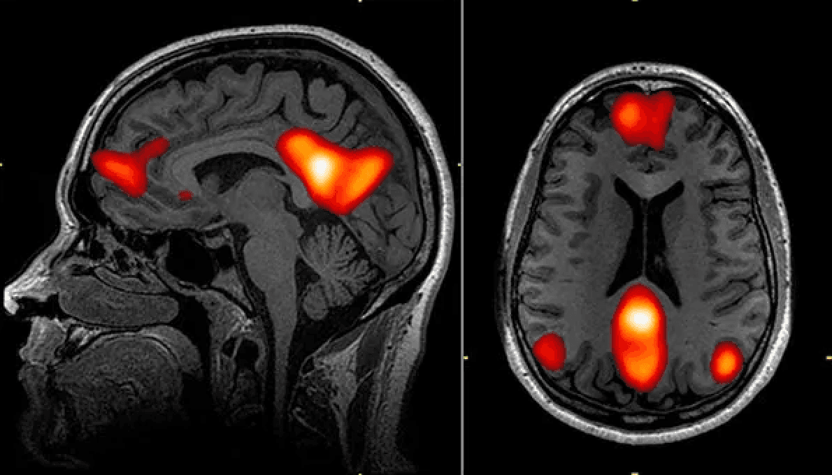 Image of Neural decoding of Dreams, a McGill AI Lab project